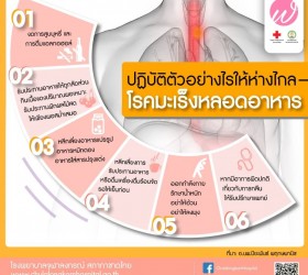 ปฏิบัติตัวอย่างไรห่างไกลมะเร็งหลอดอาหาร
