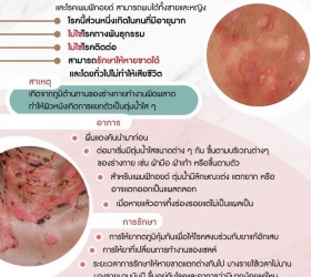 โรคตุ่มน้ำพอง